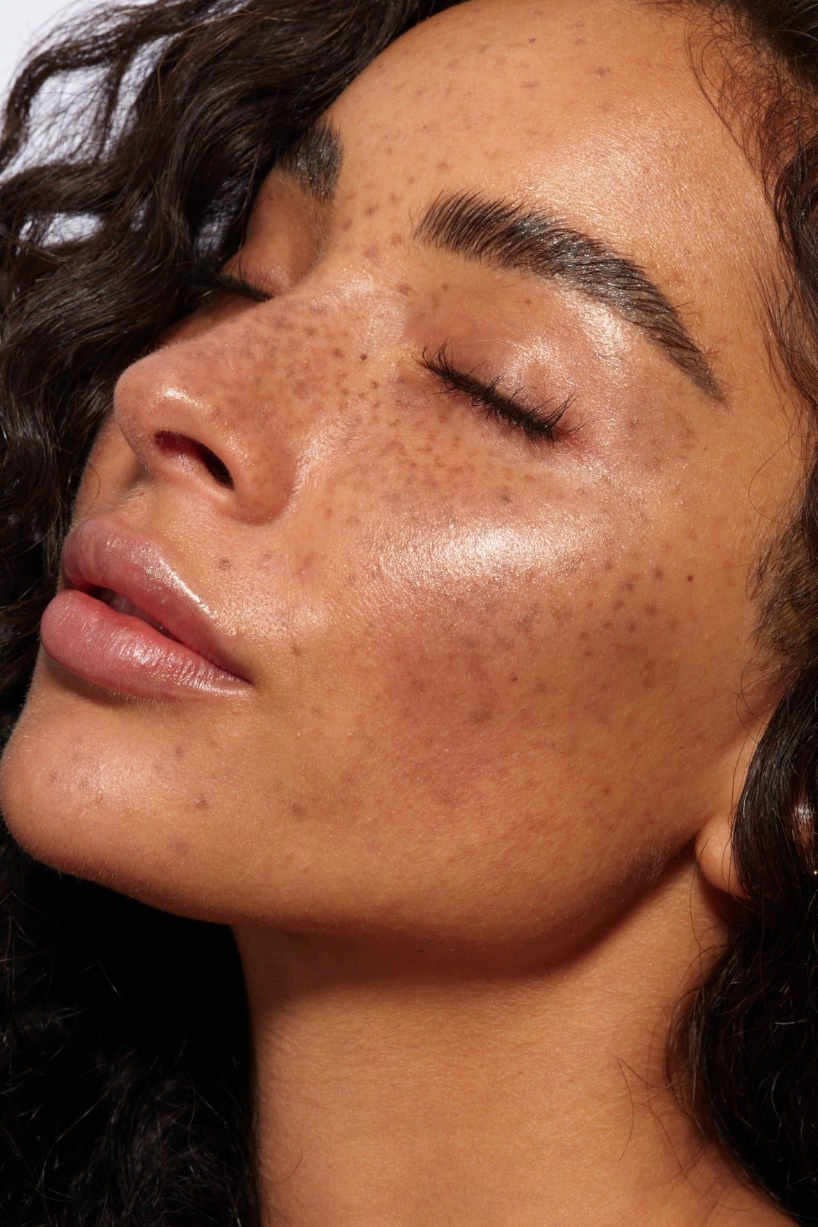 Even, glowing skin after pigmentation treatment, the best Orange County spa for pigmentation, Lemon & Honey Day Spa